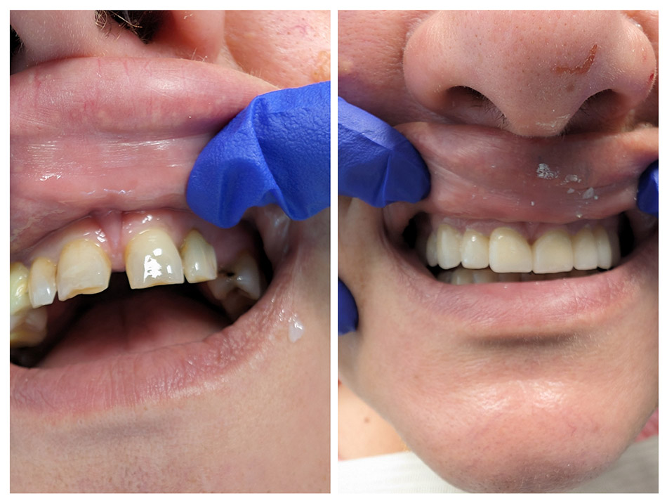 patient case photo